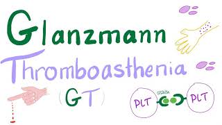 Glanzmann Thrombasthenia GT [upl. by Reinaldo]