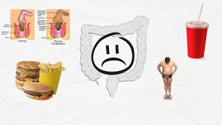 Diarrheal diseases [upl. by Ainival]