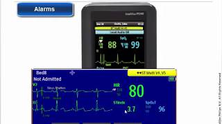 Philips IntelliVue MX40 Patient Monitor  Alarms [upl. by Tnirb708]