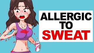 Allergic To Sweat [upl. by Rozanne540]