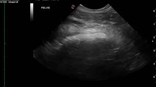 Classic Stump Pyometra [upl. by Enaed]