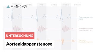 Aortenklappenstenose  Herzgeräusch  AMBOSS Video [upl. by Brannon]