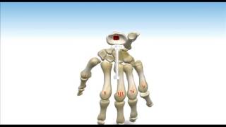 ReMotion™ Total Wrist Arthroplasty  Animated Surgical Technique [upl. by Nnylaj]