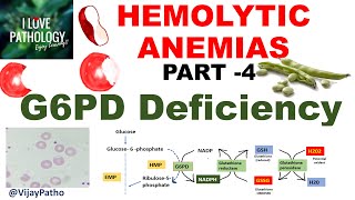 Hemolytic Anemias Part 4 G6PD Deficiency PathophysiologyMorphology clinical features [upl. by Suilmann450]