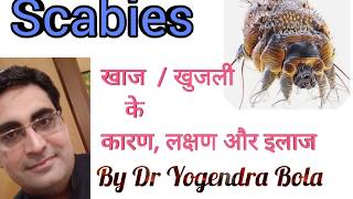 SCABIES COMPLETE CURE and treatment by DR YOGENDRA BOLA in hindiरात को होने वाली खुजली का इलाज [upl. by Enerol643]