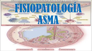 ASMA ETIOLOGÍA FISIOPATOLOGÍA Y DIAGNÓSTICO [upl. by Aikaj]