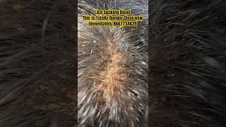 Lice removal treatmenthow lice grow in hairhow to prevent licelice treatment in parlourlice [upl. by Wilkie]