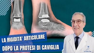 Perchè muovere subito la caviglia dopo lintervento di protesi di caviglia  Dott Andrea Scala [upl. by Akinoj]