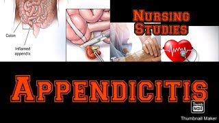 Complete lecture on Appendicitis  Pathophysiology  Medical Surgical nursingstudies [upl. by Onateag]