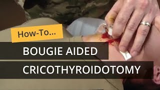 Bougie Aided Cricothyroidotomy [upl. by Gunilla369]