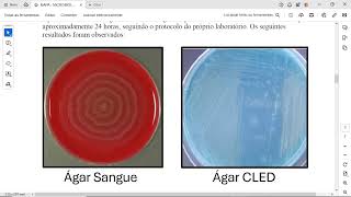 c INTERPRETE o resultado do teste do tubo germinativo sugerindo o provável patógeno [upl. by Sivartal]