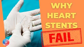 WHY heart stents FAIL [upl. by Bowles701]