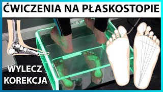 Ćwiczenia na płaskostopie 👣 KOREKCJA STOPY PŁASKIEJ wylecz wadę postawy TRENING MEDYCZNY [upl. by Yebba]