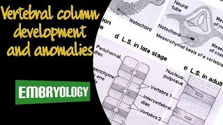 Vertebral column development and anomalies Embryology  DrMedhat Atta [upl. by Trstram]