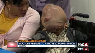 Doctors in Florida to Remove 10pound Tumor from Boys face [upl. by Yadsnil]