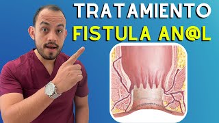 🔴 𝗙𝗜𝗦𝗧𝗨𝗟𝗔 𝗔𝗡𝗔𝗟 Síntomas Causas y Tratamiento [upl. by Esiuqcaj]