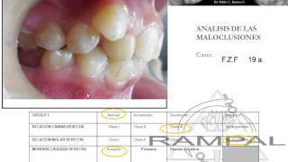 Diagnostico y Plan de Tratamiento N°52 [upl. by Ardnohs]