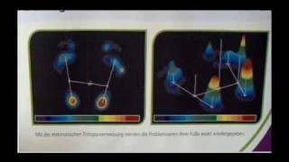 Fußelastic Fußanalyse und Trittspurvermessung [upl. by Eiramlatsyrc]