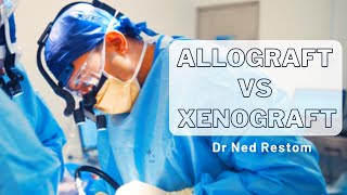 Interview with Dr Ned Restom  Allograft vs Xenograft [upl. by Foy]