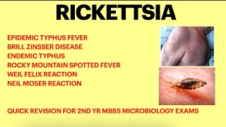 Rickettsia  Microbiology  Typhus fever  Weil felix test Rickettsial infection [upl. by Yraillih]