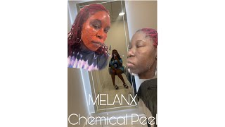 MelanX Chemical Peel Is It Worth 900 🤔 [upl. by Inus996]