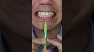 Nobel Super Soda Candy ASMR with for and pat6 shorts [upl. by Bern]