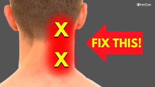 How to Fix Neck Pain off to the Side [upl. by Ahsiki]