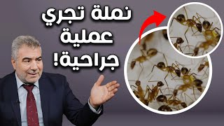 أمر لا يصدق نملة تجري عملية جراحية شاهد إبداع الخالق [upl. by Yahsat]