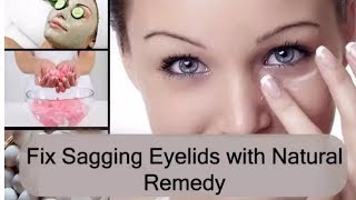 Lift Your Droopy Eyelids In Less Than 10 Days  how to fix droopy eyelids without surgery [upl. by Refinney]