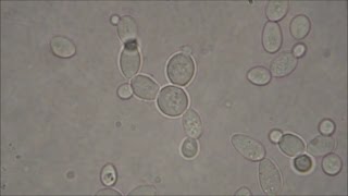 Bakers Yeast under the Microscope [upl. by Elda]