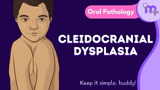 Cleidocranial Dysplasia  Features  Oral Manifestation  Treatment  Oral Pathology  Animated [upl. by Atinrev]