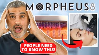 Plastic Surgeon Reveals the REAL TRUTH about Morpheus 8 [upl. by Atnauqahs10]