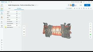 Medit Temporaries  PreForm Workflow [upl. by Hedges]