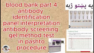 antibody identification panel  antibody screening gel method  blood bank part 4  in pashto [upl. by Nivrag712]