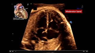 Embryology Development of the Placenta and Fetal Circulation Animation [upl. by Liagibba]