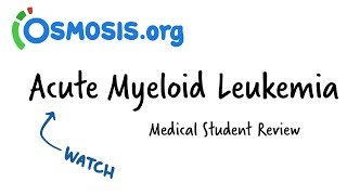 Acute Myeloid Leukemia  Clinical Presentation [upl. by Attenwahs731]