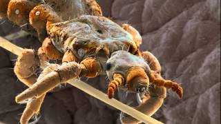 Human head louse pediculus humanus capitis under a scanning electron microscope [upl. by Hett371]