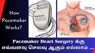 how pacemaker works  Heart charging machine  Pacemaker life expectancy  Breathing machine [upl. by Ginnie]