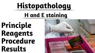 Histopathology H and E staining Principle reagents Procedure Results Tissue staining [upl. by Ireland443]