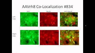 Research Webinar Gene Silencing approaches for HD [upl. by Atsillak]