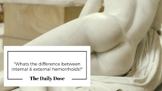 Whats the difference between internal amp external hemorrhoids [upl. by Phillips]