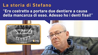 IMPIANTI ZIGOMATICI La Testimonianza della Rinascita di Stefano [upl. by Phyl]