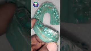 Upper  Lower  Toothsi  Maxillary  Mandible  Removable Appliance  Tamil Dental Lab dentallab [upl. by Dragde286]