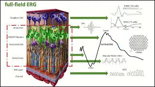 Rocol amp Roland Consult Summit ERG de campo completoERG multifocal y EOG [upl. by Dulcy453]