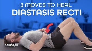 3 Moves To Heal Diastasis Recti [upl. by Schlessinger]