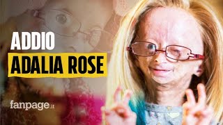 Morta Adalia Rose la youtuber 15enne che raccontava la sua vita con la progeria [upl. by Nolahs644]