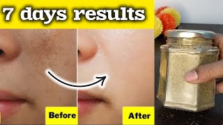 only RS19💸Tan removal  dark spots removal face pack at home😍DIY Home remedy for glowing skin🏡 [upl. by Aihsekram]