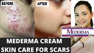 Mederma Cream Review And Uses In Hindi  दाग मिटाने की सबसे अच्छी क्रीम  mederma scars cream [upl. by Anirbys]