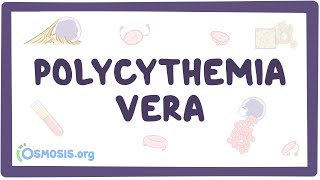 Polycythemia vera  causes symptoms diagnosis treatment pathology [upl. by Atolrac]