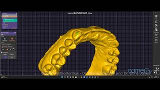 Exocad  Design of Bleach Tray Models [upl. by Roanna]